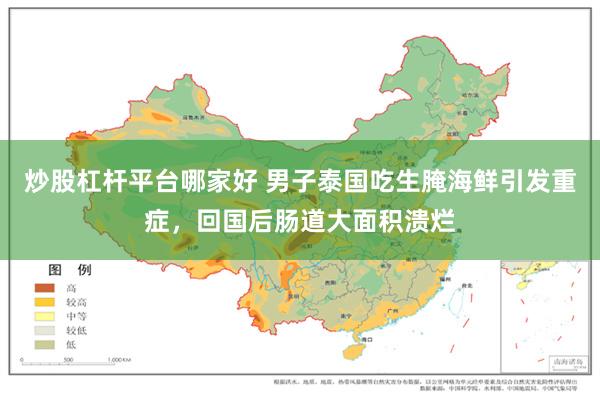 炒股杠杆平台哪家好 男子泰国吃生腌海鲜引发重症，回国后肠道大面积溃烂